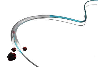 rebirth pro2 aspiration catheter