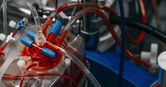 Cardiovascular - Understanding the procedure