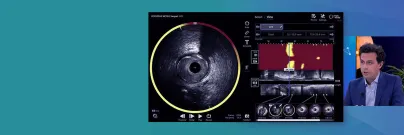 benefits of IVUS